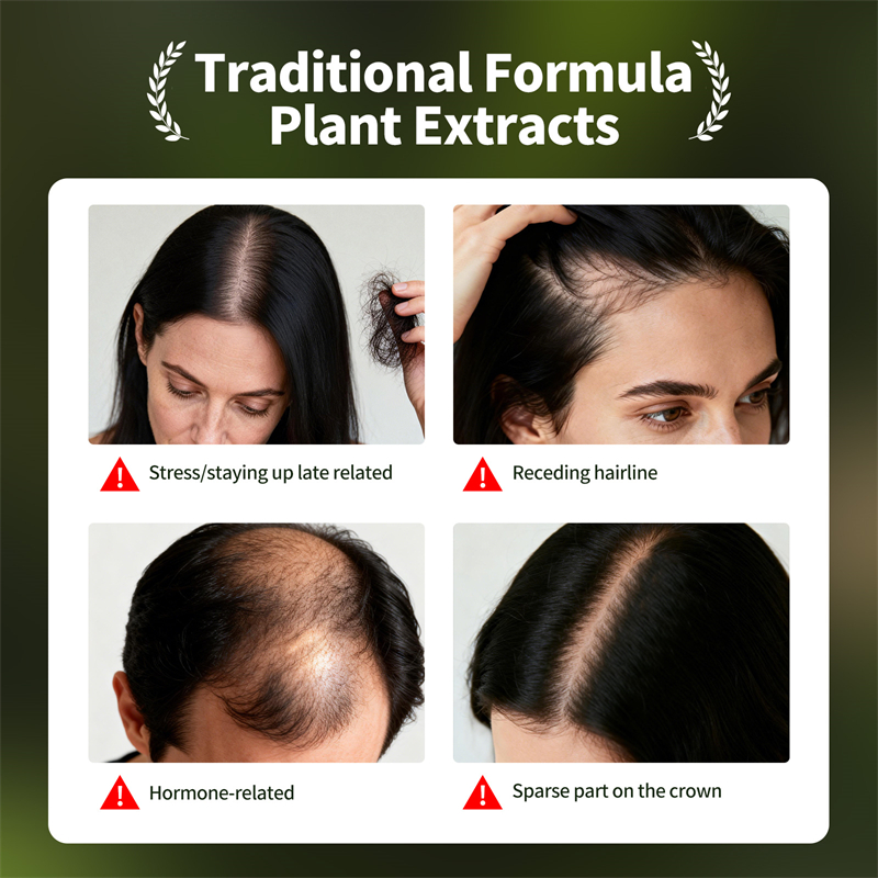 Ensemble de croissance naturel - Hair Care Herbal avis et prix