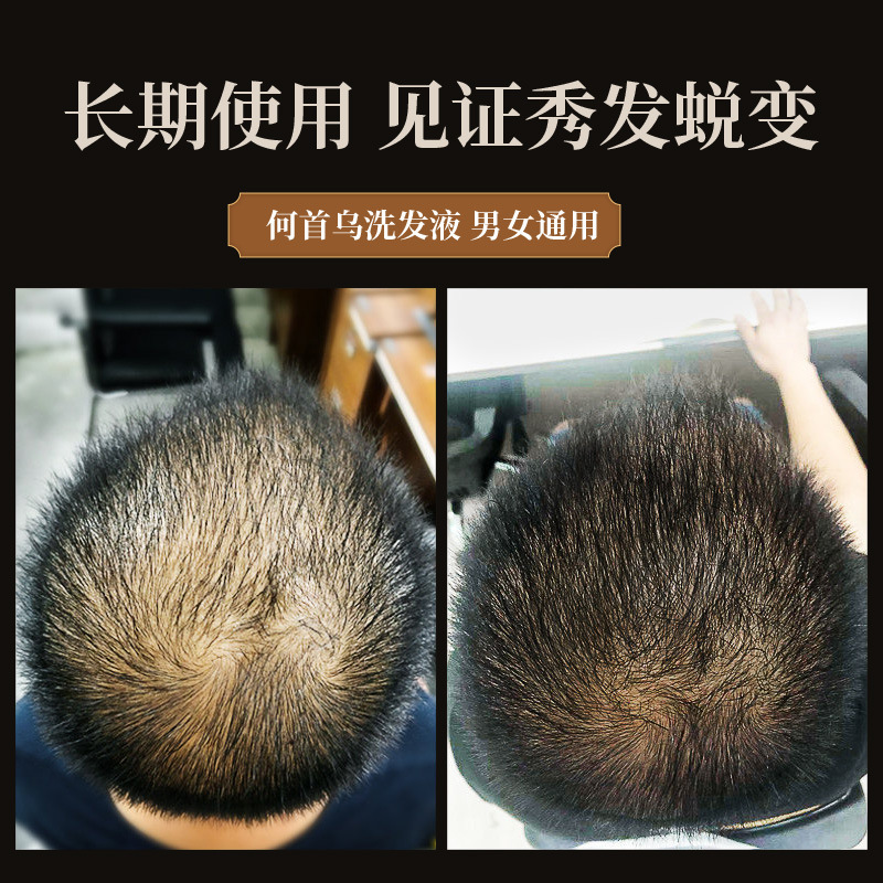 Shampoing Polygonum multifloru - Hair Care Herbal avis et prix