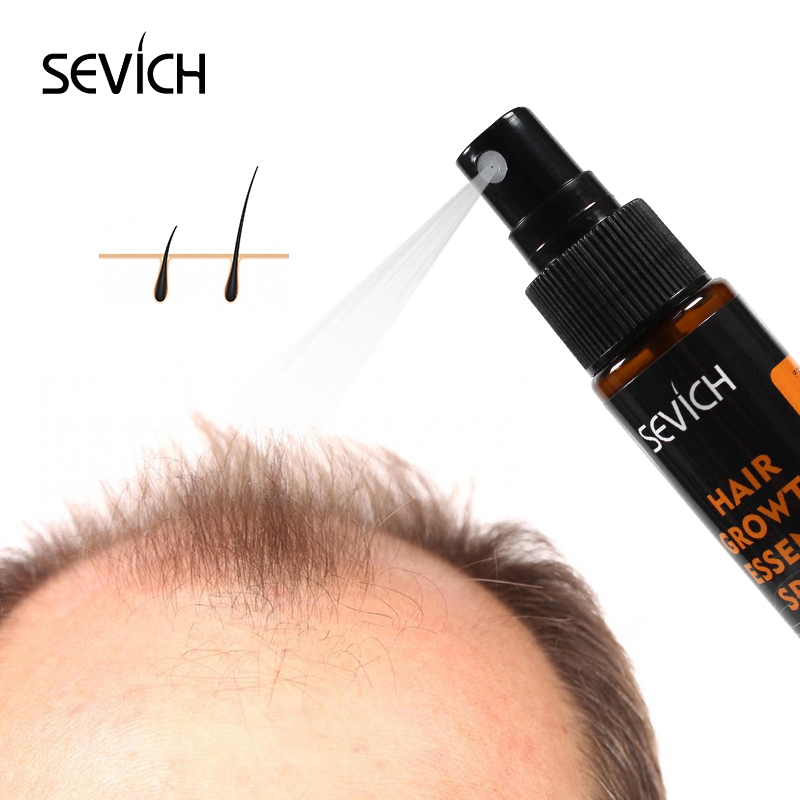 Priority ich-Huile HeRhEssence - Hair Care Herbal avis et prix