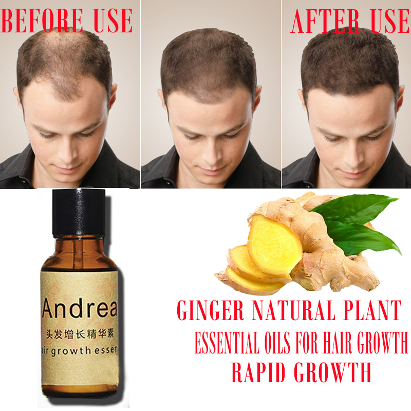 Andrea – sérum pour la croissa - Hair Care Herbal avis et prix