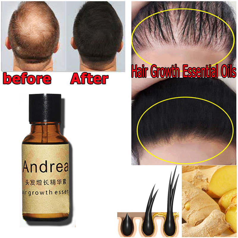 Andrea – sérum pour la croissa - Hair Care Herbal avis et prix