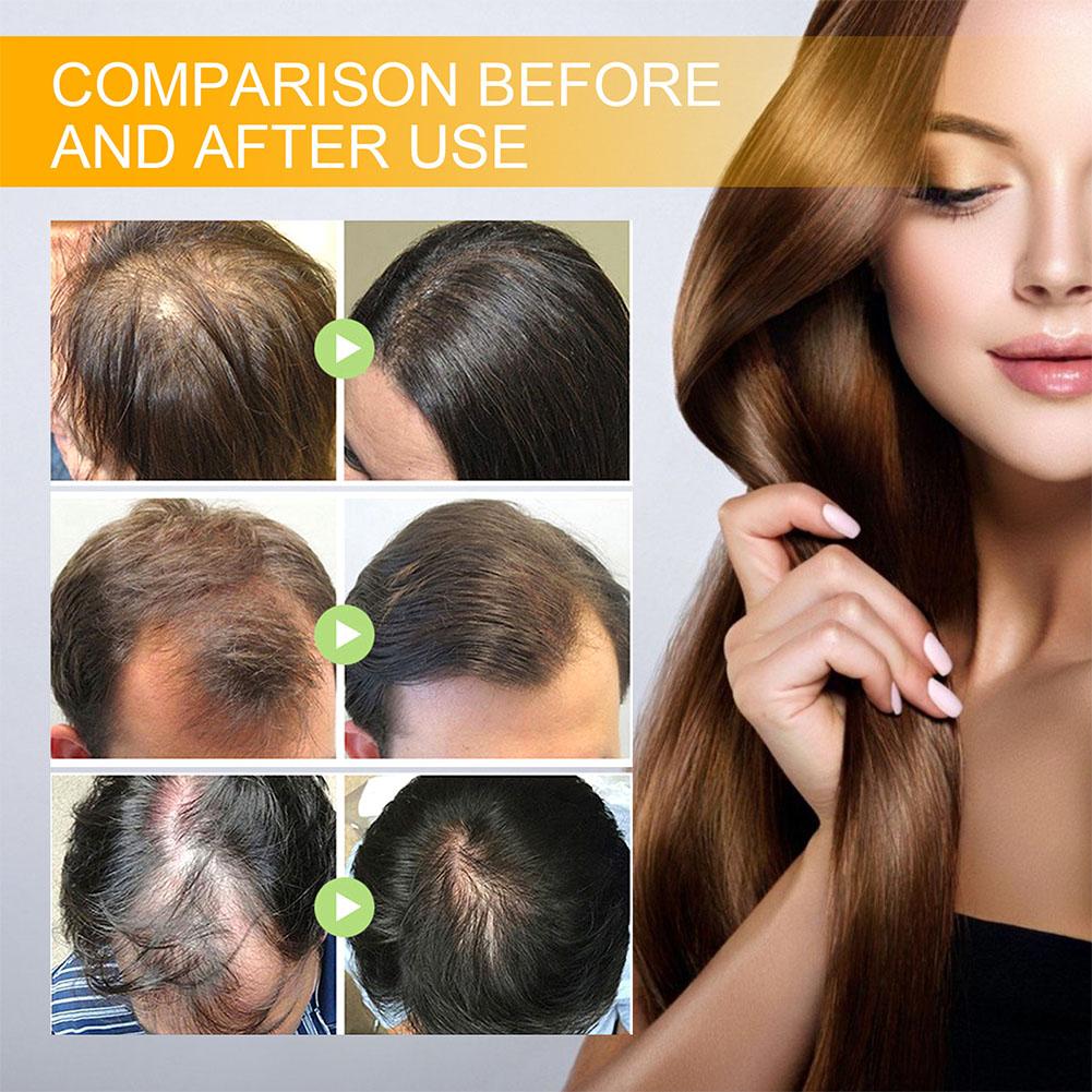 5/3/1 pièces biotine produits  - Hair Care Herbal avis et prix